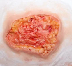 ForensicFX Studios Deep Fatty Tissue Wound Prosthetic></noscript> Halloween Accessories