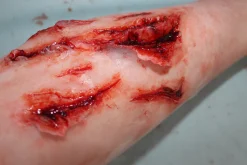 ForensicFX Studios Deep Leg Lacerations Prosthetic></noscript> Halloween Accessories