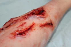 ForensicFX Studios Deep Leg Lacerations Prosthetic></noscript> Halloween Accessories