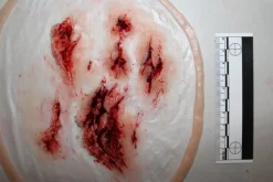 ForensicFX Studios Deep Leg Lacerations Prosthetic></noscript> Halloween Accessories
