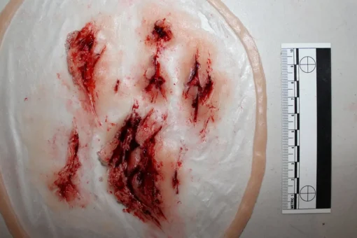 ForensicFX Studios Deep Leg Lacerations Prosthetic> Halloween Accessories