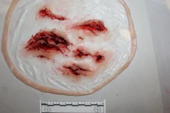 ForensicFX Studios Deep Leg Lacerations Prosthetic></noscript> Halloween Accessories
