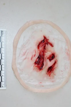 ForensicFX Studios Deep Opened Mangled Wounds Prosthetic></noscript> Halloween Accessories
