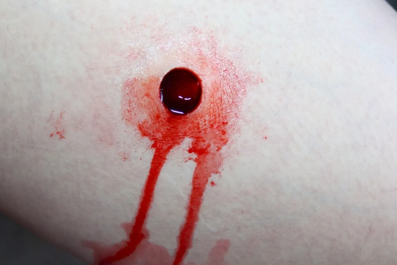 ForensicFX Studios Entry & Exit Bullet Wound Prosthetic> Halloween Accessories