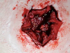 ForensicFX Studios Exit Bullet Wound Prosthetic></noscript> Halloween Accessories