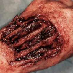 ForensicFX Studios Gorey Prosthetics Bundle></noscript> Halloween Accessories