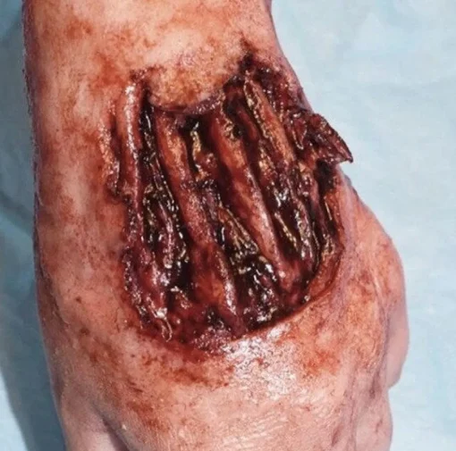 ForensicFX Studios Gorey Prosthetics Bundle> Halloween Accessories