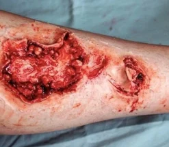 ForensicFX Studios Gorey Prosthetics Bundle></noscript> Halloween Accessories