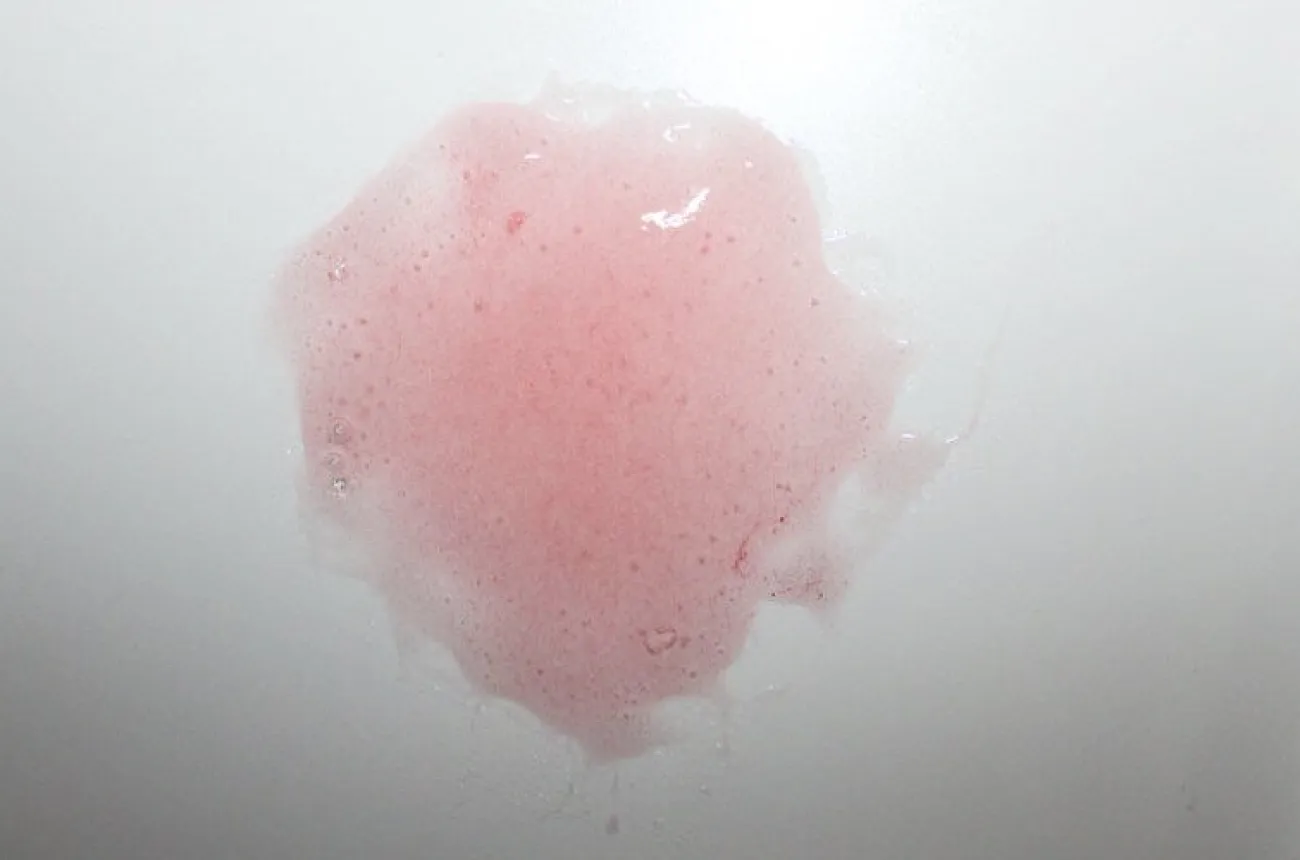 ForensicFX Studios Infected Wound / Burn Prosthetic> Halloween Accessories