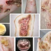 ForensicFX Studios Infected/Burn Wound Prosthetics Bundle> Halloween Accessories
