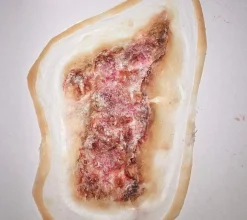 ForensicFX Studios Infected/Burn Wound Prosthetics Bundle></noscript> Halloween Accessories