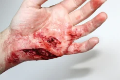 ForensicFX Studios Knife Lacerations Prosthetic></noscript> Halloween Accessories