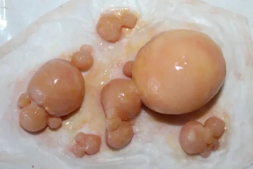 ForensicFX Studios Large Infected Boils Prosthetic> Halloween Accessories