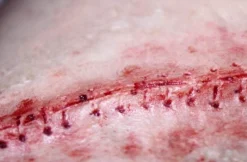 ForensicFX Studios Opened Stitches Prosthetic></noscript> Halloween Accessories
