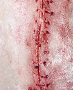 ForensicFX Studios Opened Stitches Prosthetic></noscript> Halloween Accessories