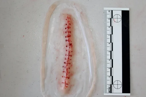 ForensicFX Studios Opened Stitches Prosthetic> Halloween Accessories