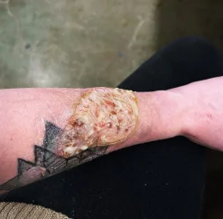ForensicFX Studios Pus Makeup Effect Gel></noscript> Halloween Accessories
