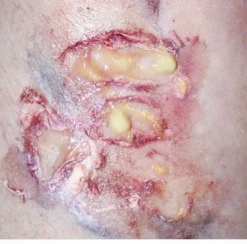 ForensicFX Studios Pus Makeup Effect Gel></noscript> Halloween Accessories