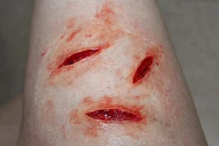 ForensicFX Studios Simple Prosthetics Bundle></noscript> Halloween Accessories