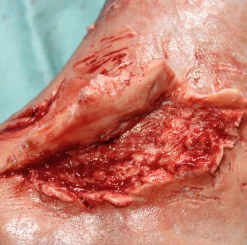 ForensicFX Studios Skin Peeling Back Wound Prosthetic></noscript> Halloween Accessories