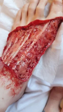 ForensicFX Studios Skinned Alive Prosthetic Bundle></noscript> Halloween Accessories