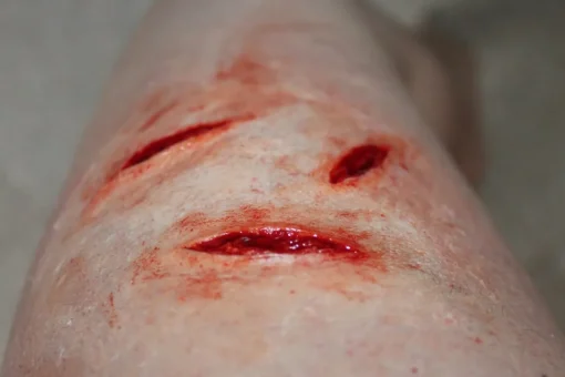 ForensicFX Studios Small Shallow Knife Stab Wounds (X3) Prosthetic> Halloween Accessories