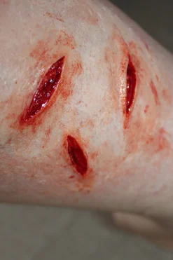 ForensicFX Studios Small Shallow Knife Stab Wounds (X3) Prosthetic></noscript> Halloween Accessories