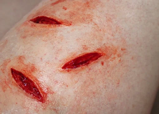 ForensicFX Studios Small Shallow Knife Stab Wounds (X3) Prosthetic> Halloween Accessories