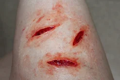 ForensicFX Studios Small Shallow Knife Stab Wounds (X3) Prosthetic></noscript> Halloween Accessories