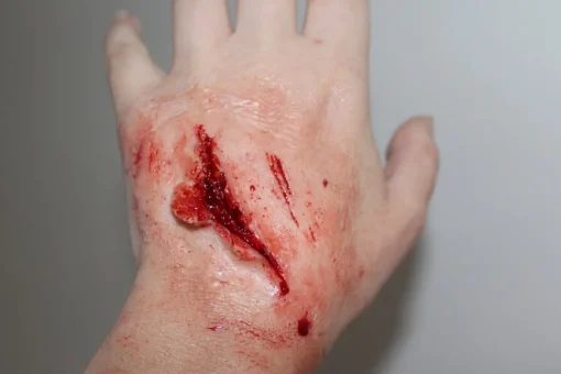 ForensicFX Studios Small Shallow Laceration Prosthetic> Halloween Accessories
