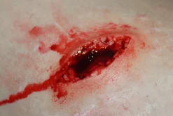ForensicFX Studios Stab Wound Prosthetic><noscript><img width=