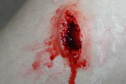 ForensicFX Studios Stab Wound Prosthetic><noscript><img width=
