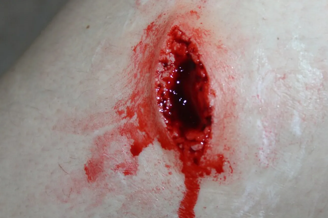 ForensicFX Studios Stab Wound Prosthetic> Halloween Accessories