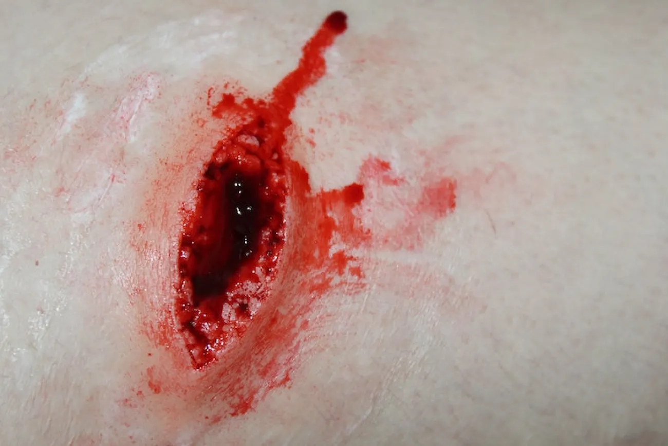 ForensicFX Studios Stab Wound Prosthetic> Halloween Accessories