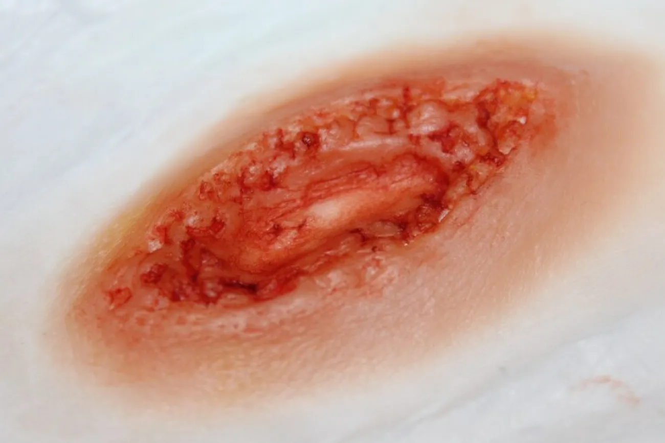 ForensicFX Studios Stab Wound Prosthetic> Halloween Accessories