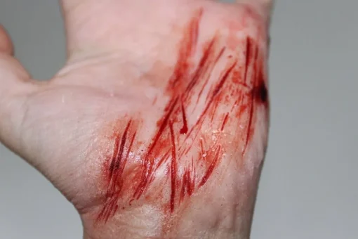 ForensicFX Studios Thin Cuts Prosthetic Bundle> Halloween Accessories