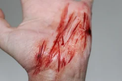 ForensicFX Studios Thin Scrapes Prosthetic></noscript> Halloween Accessories
