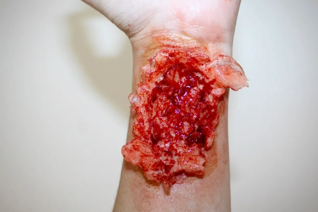 ForensicFX Studios Torn Wrist Prosthetic> Halloween Accessories
