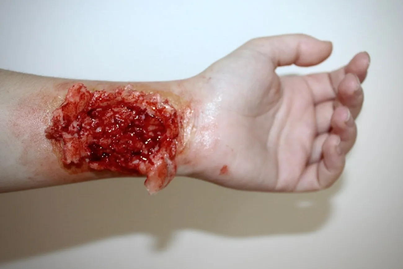 ForensicFX Studios Torn Wrist Prosthetic> Halloween Accessories