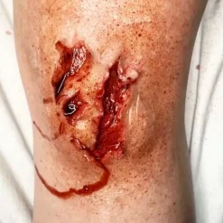 ForensicFX Studios Trauma Wounds Prosthetic Bundle></noscript> Halloween Accessories